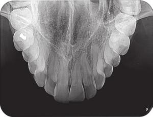 Dzięki VistaScan Mini wykorzystują Państwo zalety technologii pamięciowych płyt obrazowych firmy Dürr Dental w najbardziej kompaktowej formie.