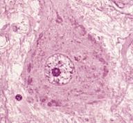 Komórka nerwowa ultrastruktura Jądro pęcherzykowe duże okrągłe, ze słabo wybarwiającym się zrębem chromatynowym, z