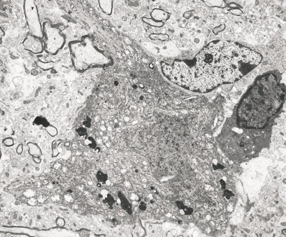 Tigroid Aparat Golgiego dobrze rozbudowany (procesy wydzielnicze) Mitochondria w dużej liczbie, zaspakajające