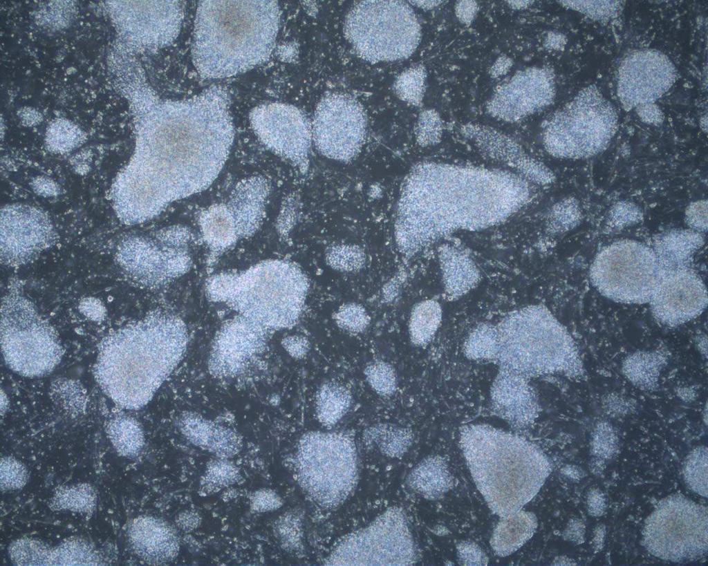 Segmentacja oparta na histogramie bimodalnym 140 120 100 80 60 40 T
