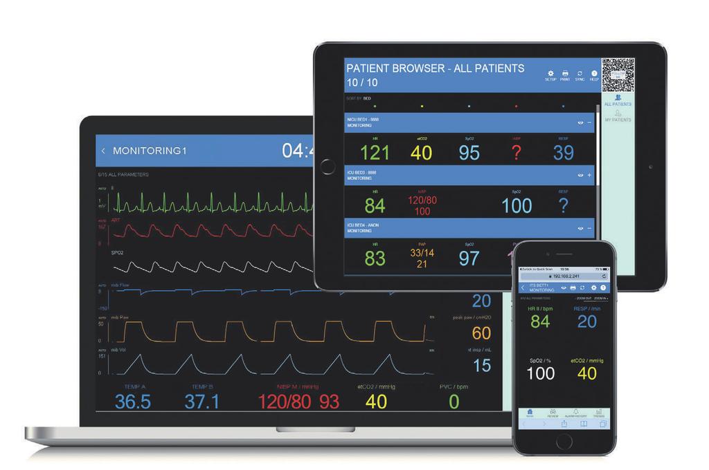 Infinity MView Mobility System monitorowania pacjenta Infinity MView Mobility umożliwia dostęp do szerokiego zakresu danych klinicznych w miejscu, gdzie są one potrzebne.