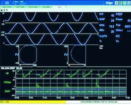 04 Infinity MView Mobility Komponenty systemu Oprogramowanie Infinity Gateway Suite Server Infinity Gateway jest zestawem aplikacji opartych na otwartych standardach, umożliwiających przekazywanie