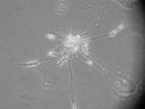 Wyniki A) Kontrola B) 0,75 µm βt CysPAI-1 C) 1,5 µm βt CysPAI-1 D) 3,0 µm βt CysPAI-1 Ryc XIX Agregaty komórek śródbłonka ludzkiej żyły pępowinowej hodowane w obecności rosnących stężeń postaci βt