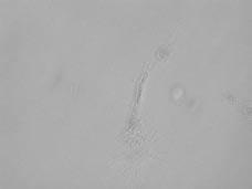 J. Chorostowska-Wynimko A) Kontrola B) 0,75 µm βt CysPAI-1 C) 1,5 µm βt CysPAI-1 D) 3,0 µm βt CysPAI-1 Ryc.
