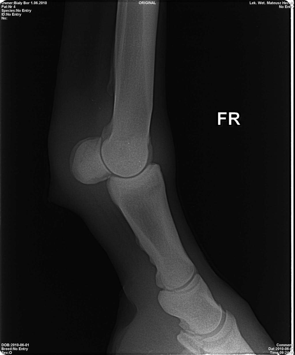 Na zdjęciu rentgenowskim powinny być widoczna dokładnie szpara stawu pęcinowego, grzebień pośrodkowy kości śródręcza lub śródstopia III oraz
