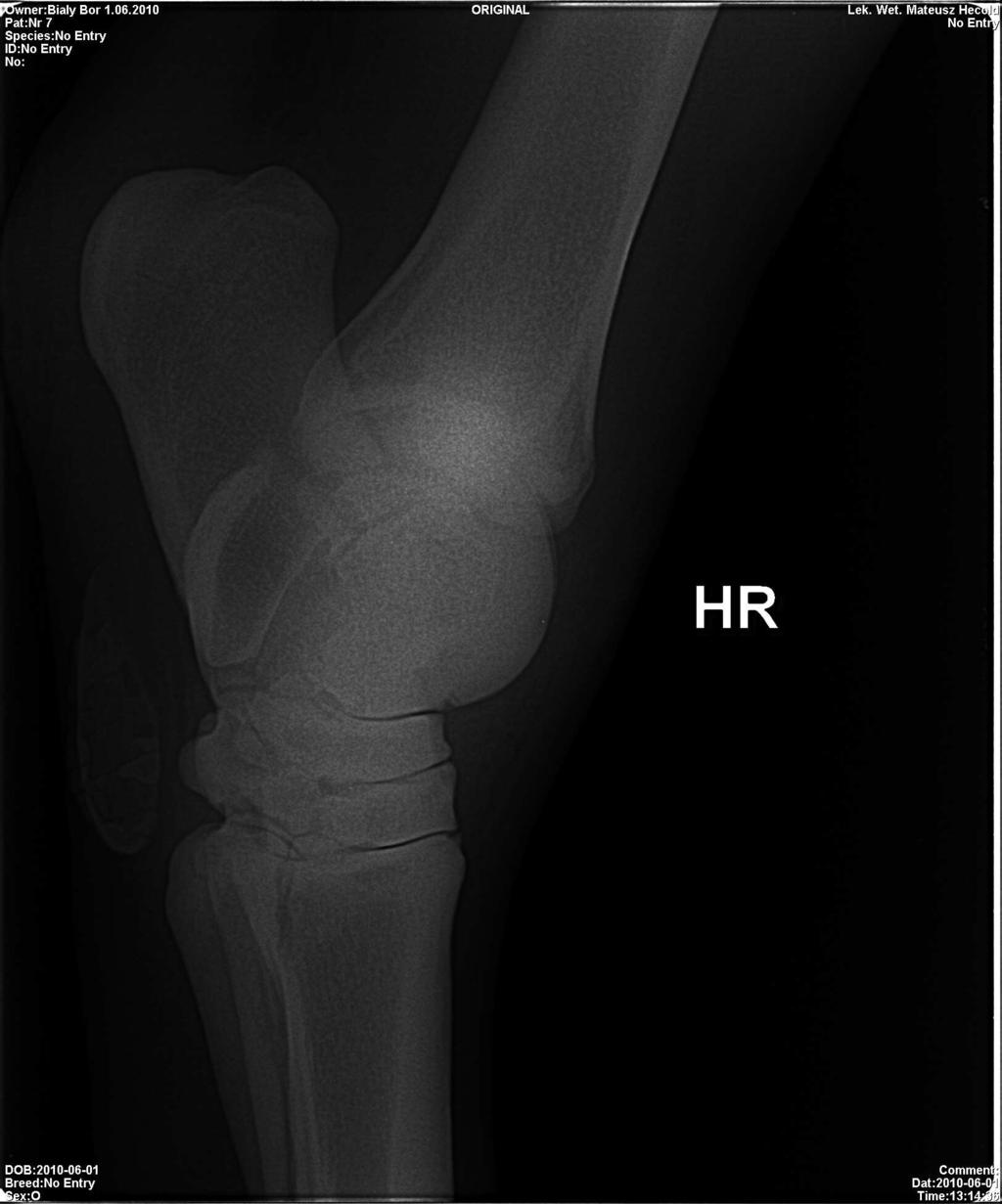 Na zdjęciu rentgenowskim powinny być widoczna dokładnie szpary stawowe, bloczki kości skokowej i grzebień pośrodkowy kości piszczelowej.