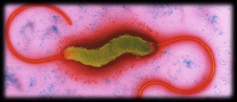 Campylobacter sp. Mikroaerofilne, ruchliwe pałeczki - posiadają długie rzęski, umieszczone na jednym lub obu biegunach Zakażenia wywołane przez Campylobacter spp. (najczęściej gatunek C.