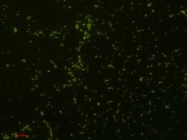 Szczep bakterii Pantoea agglomerans wchodzący w skład Bioilsy wzbogaconej.