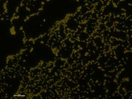 Szczep bakterii Pseudomonas fluorescens wchodzący w skład kwasów humusowych wzbogaconych.