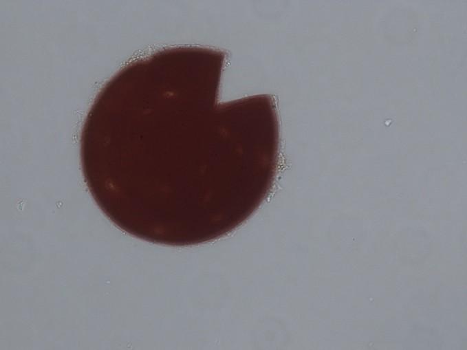 Zarodnik AGM. Zarodnik AGM Scutellospora dipurpurescens.
