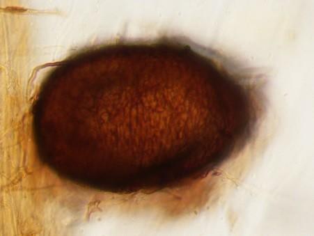 Wyniki obserwacji mikroskopowych potwierdzają korzystny wpływ biopreparatu Micosat F na stopień frekwencji mikoryzowej oraz formowanie struktur grzybów mikoryzowych w korzeniach wiśni odmian Sabina i