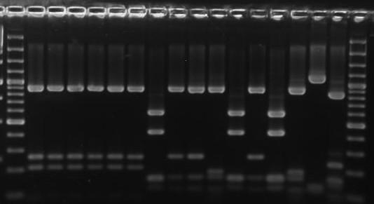 Identyfikacja izolatów bakterii z użyciem techniki ARDRA Przy zastosowaniu techniki ARDRA amplifikowano gen 16S rrna (Lane 1991), a uzyskany produkt PCR trawiono czterema enzymami restrykcyjnymi:
