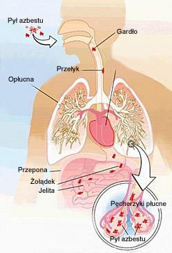Chorobotwórcze działanie azbestu jest wynikiem wdychania włókien zawieszonych w powietrzu Ryzyko wchłaniania