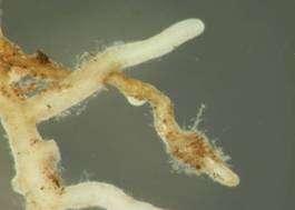 Scleroderma