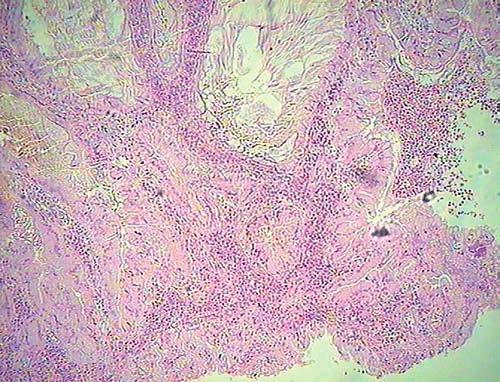 Histopathological changes of rete ovarii in bitches with cystic endometrial hyperplasia-pyometra complex Katkiewicz M., Witkowski M.