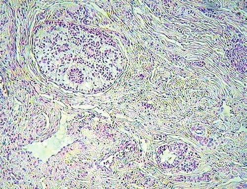 of this article was to present and characterize a distinct disease syndrome, associated with cystic endometrial hyperplasia, in bitches.