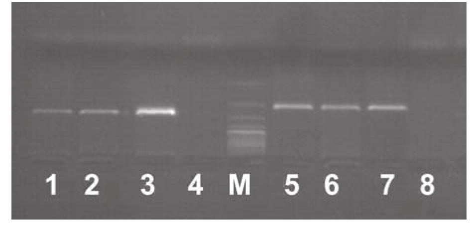 Kontrola pozytywna PCR dla bydła dała produkt reakcji PCR o długości 271 pz, dla kur produkt 266 pz, dla owiec 226 pz, a dla świń 212 pz. Fot. 2. Analiza resztek paszy pobranej ze ściółki w kurniku na obecność w niej komponentu drobiowego Fig.