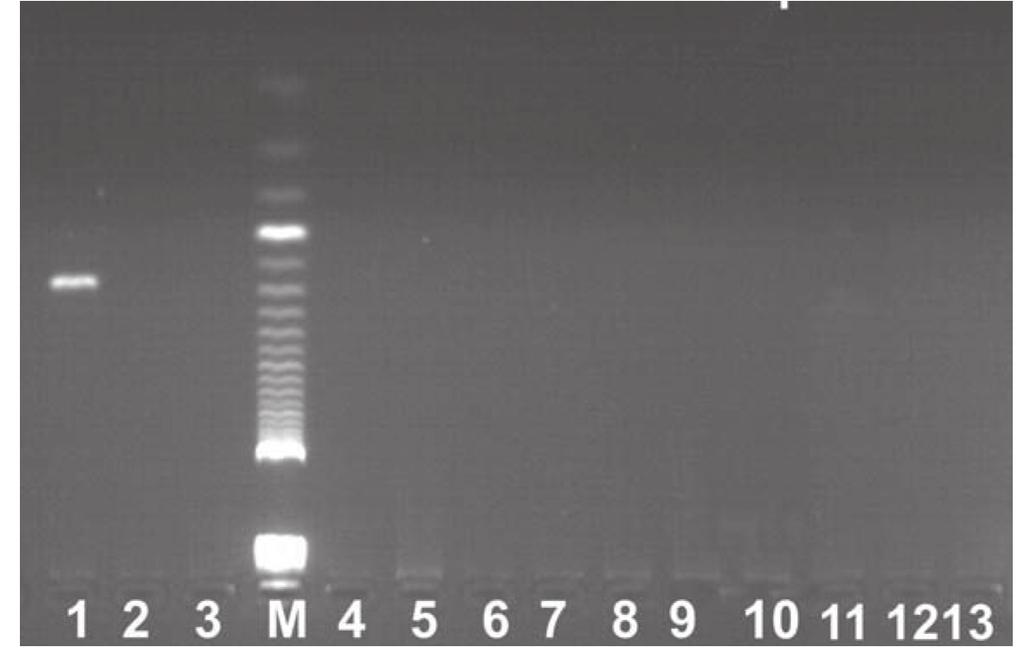 Modyfikacja metody identyfikacji gatunkowej 21 163 pz uzyskano jedynie dla DNA wyizolowanego z tkanki psa. DNA pochodzące od pozostałych gatunków nie dało produktu reakcji. Tabela 1.
