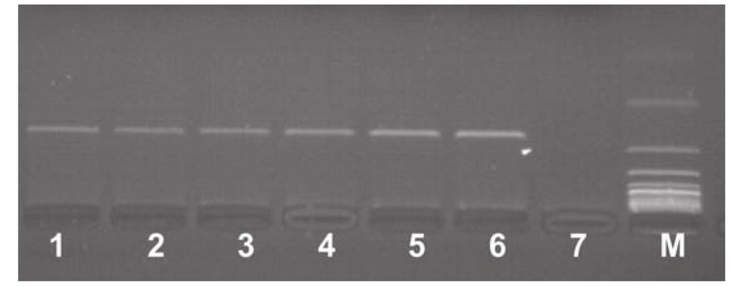22 M. Natonek-Wiśniewska i P. Krzyścin Fot. 5. Analiza smalcu w kierunku identyfikacji w nim komponentów pochodzących od psa Fig. 5. Analysis of lard for identification of canine components Obraz elektroforezy produktów reakcji PCR dla komponentu pochodzącego od psa.