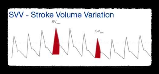 ODPOWIEDŹ NA PŁYNY PARAMETRY STATYCZNE PARAMETRY DYNAMICZNE CVP PCWP Michard F, Teboul JL: Predicting fluid responsiveness in ICU patients: a critical analysis of the