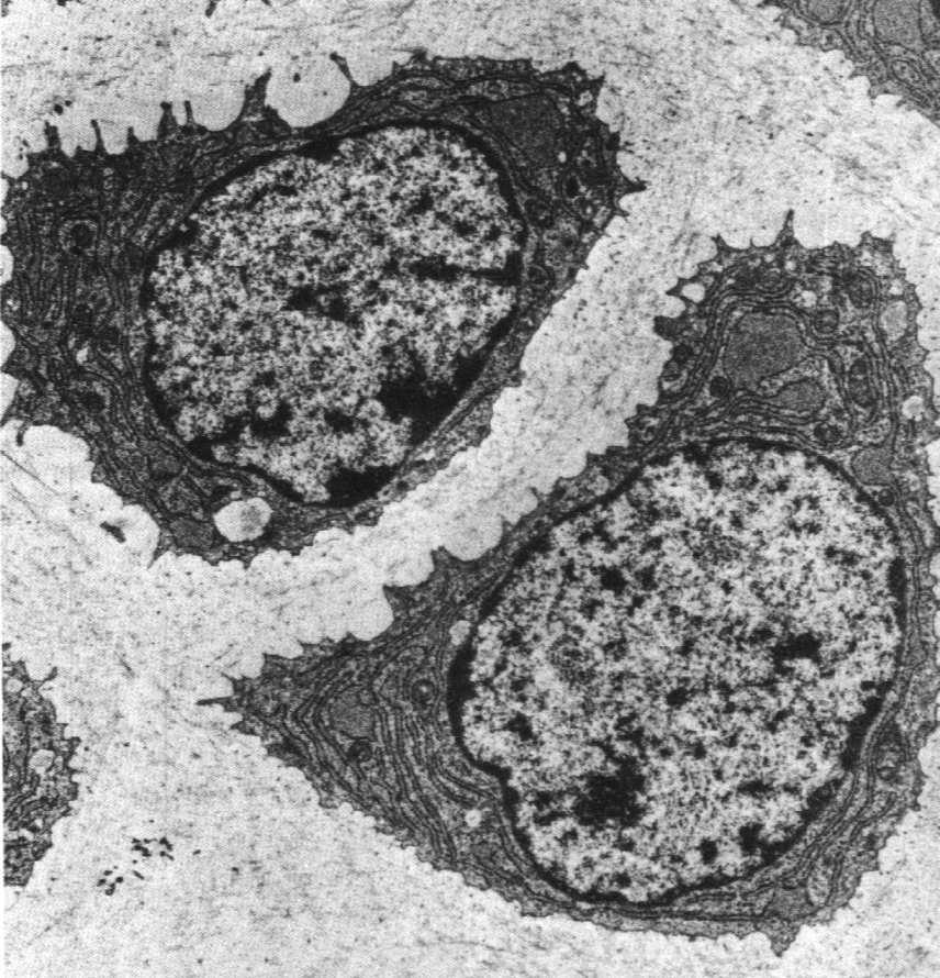 chondrogenne - chondroblasty - chondrocyty substancja międzykomórkowa: - włókna kolagenowe -