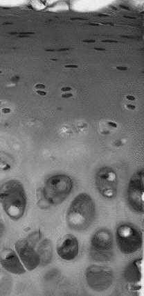 chondrogennymi chondrocyt macierz torebkowa macierz terytorialna grupa izogeniczna macierz