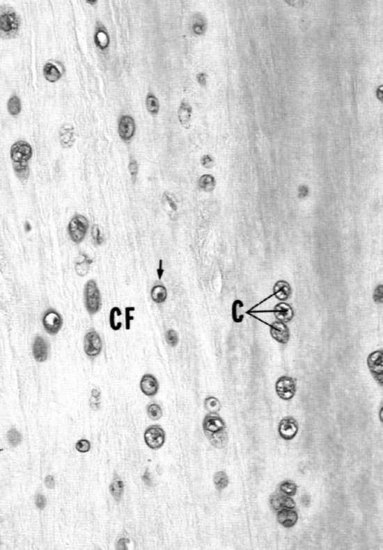 osteoblasty - osteocyty - osteoklasty substancja międzykomórkowa: - fosforany wapnia (ok.