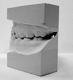 Occlusal