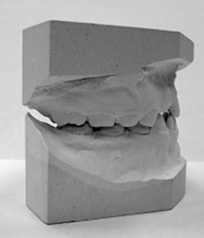 Primary Teeth 615
