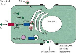 ATP7B transporter The excess