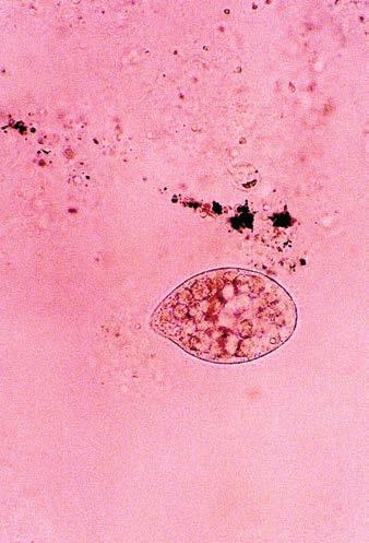 Ryc. 7. Tetrahymena corlissi, preparat barwiony błękitem metylenowym Ryc. 8.