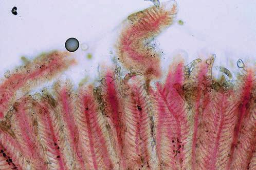 Sphaerospora spp. Niedawno opisano nowego pasożyta z grupy myksozoa z rodzaju Sphaerospora występującego u karasi akwariowych (Carassius auratus auratus). Jest on identyczny morfologicznie z S.