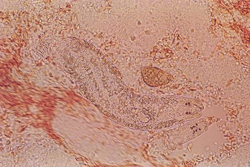 Przywry monogeniczne U ryb akwariowych bytują liczne gatunki zewnętrznych przywr monogenicznych zaliczanych do rodzajów Gyrodactylus (ryc. 14, 15), Tetraonchus (ryc. 16, 17, 18) i Dactylogyrus (ryc.