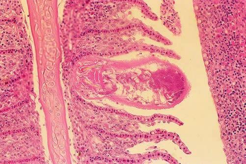 Ryc. 19. Dactylogyrus spp. w skrzelach ryby, preparat niebarwiony Ryc. 20. Dactylogyrus spp. w skrzelach ryby, preparat histologiczny barwiony hematoksyliną i eozyną wodnej.