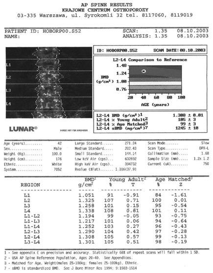 L. Wawrzyńska Rys.5.1. Przykładowy wynik badania densytometrycznego kręgosłupa lędźwiowego Normy aktywności fosfatazy zasadowej to: 91-258 IU/l, dla wapnia 4,1 5,5 me/l. 5.3.
