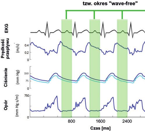 Rycina 2. Lokalizacja okresu wave-free w cyklu pracy serca Rycina 3.