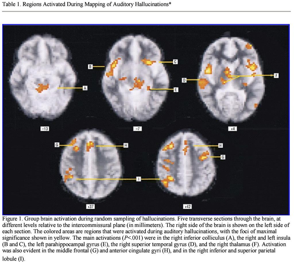 Schizofrenia