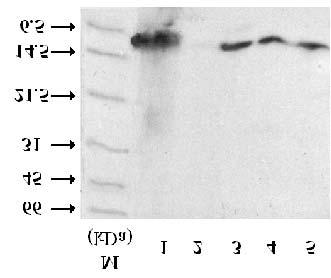 Podocytes Express the Endothelial Form at IL 8 in Human Glomerulonephritis 249 Fig. 1. Western blot analysis after SDS PAGE of pro tein extracts from kidney samples with GN.