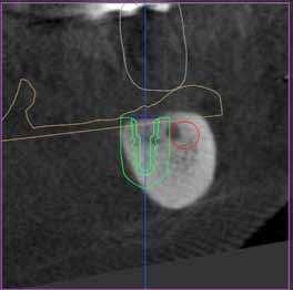 _CAD/CAM Ryc. 30 Ryc. 31 Ryc.