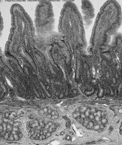 Warstewka śluzu pokrywająca powierzchnię dróg oddechowych zawiera białka antybakteryjne wydzielane przez małe