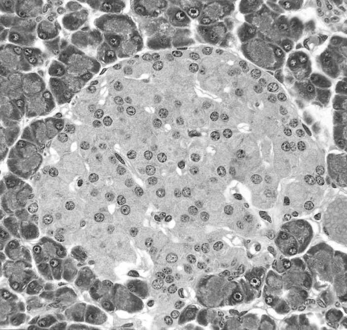 nm, okrągły ciemny rdzeń, wąskie halo Komórka beta: 300 nm, nieregularny ciemny