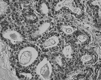 Pneumocyty II typu: fosfolipid DPPD w