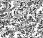 Małe komórki z nielicznymi kroplami lipidowymi mineralokortykoidy (np.