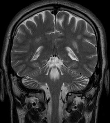 : CT and MRI imaging of the brain