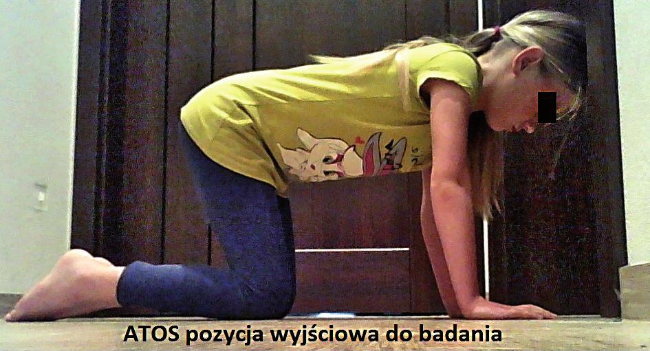 Piel Zdr Publ. 17;26(1):5 11 7 pełzania i raczkowania. Powoduje zaburzenia równowagi statycznej oraz koordynacji ruchowej.
