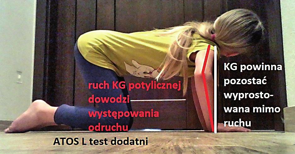 8 E.Z. Gieysztor, L. Sadowska, A.M. Choińska. Odruchy prymitywne u dzieci w wieku szkolnym i przedszkolnym Ryc. 5. Pozycja wyjściowa do testu TOB Fig. 5. Initial position for the TNR test Ryc.