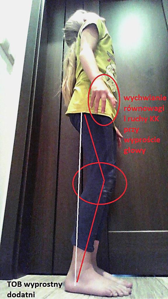 dzieci w wieku przedszkolnym. Najmniej zintegrowane pozostają odruchy ATOS L i TOB WYP.