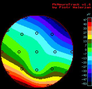 EEG mapa