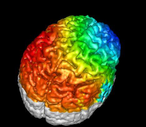 EEG + MRI