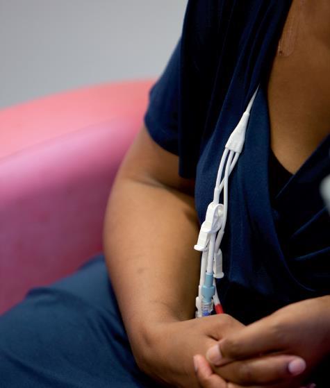 Chemotherapy can also be given through a tube in your arm or chest. This is called a PICC line or central line. The tube stays in place through the whole course of treatment.
